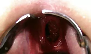 ডাবল এনাল ফিষ্টিং, প ...