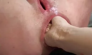 গাধ পায়ু মেক্সিকান  ...