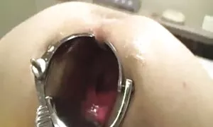 পায়ুপথ, বিশাল আৰু ন ...
